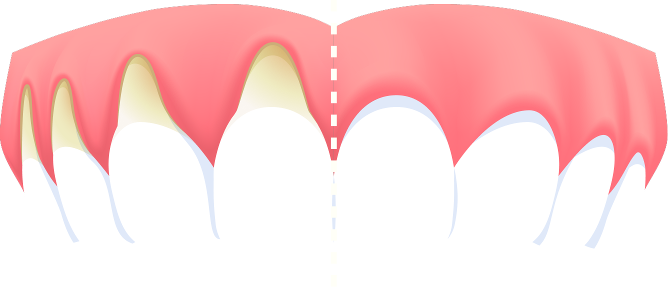 teeth