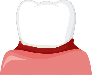 tooth